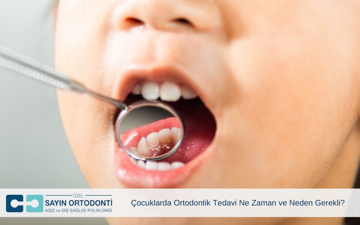 Çocuklarda Ortodontik Tedavi