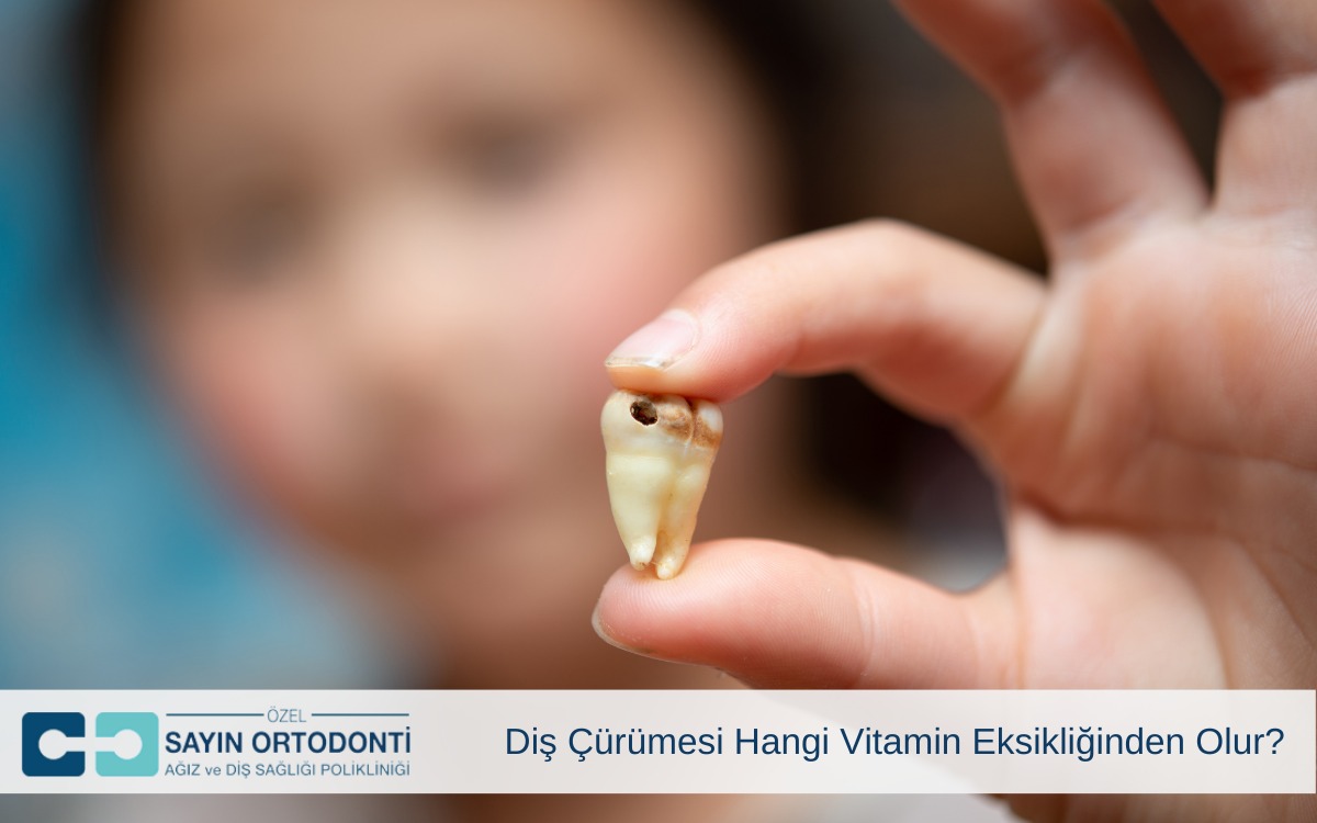 Diş Çürümesi Hangi Vitamin Eksikliğinden Olur