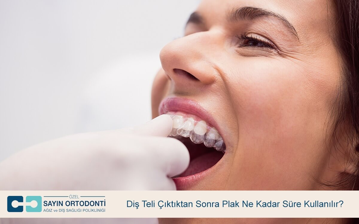 Diş Teli Çıktıktan Sonra Plak Ne Kadar Süre Kullanılır?
