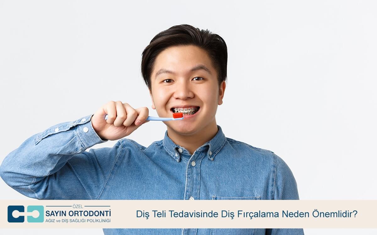 Diş Teli Tedavisinde Diş Fırçalama Neden Önemlidir?