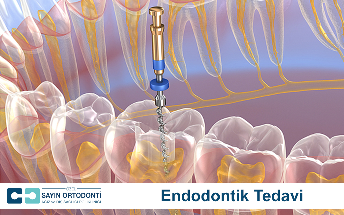 Endodontik Tedavi