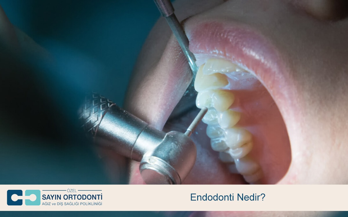 Endodonti Nedir