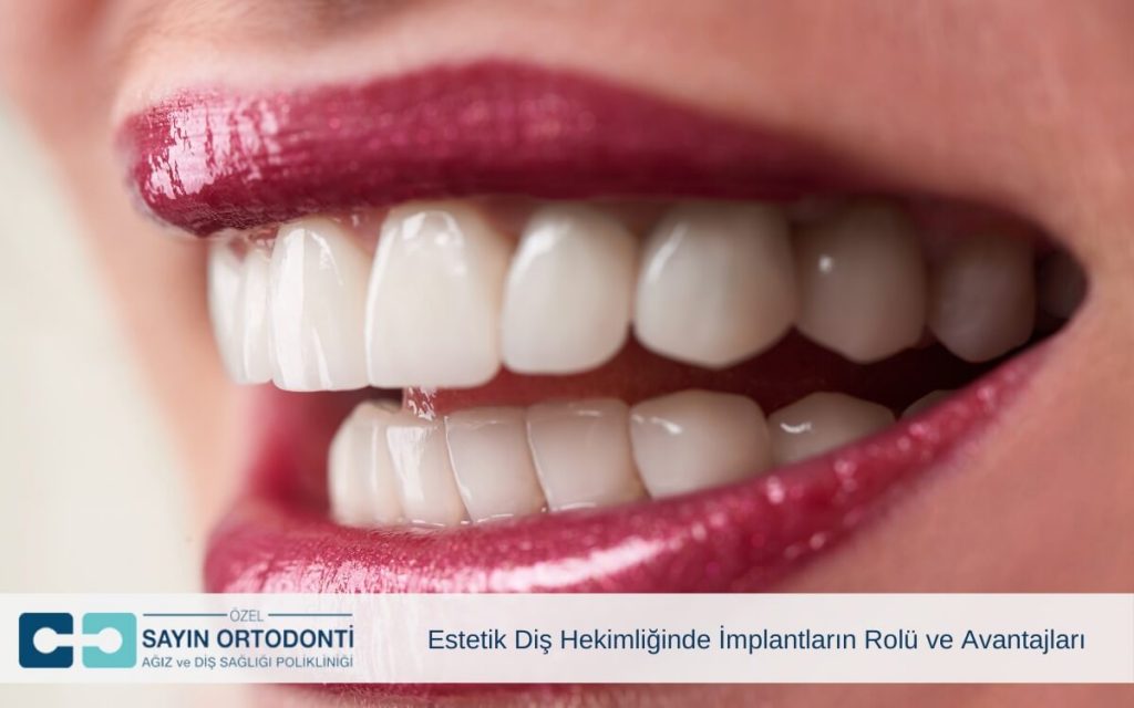 Estetik Diş Hekimliğinde İmplantların Rolü ve Avantajları