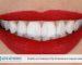Estetik ve Fonksiyon Diş Protezlerinin Hayatınızdaki Rolü