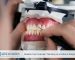 Modern Diş Protezleri Teknoloji ve Konforun Buluştuğu Yer