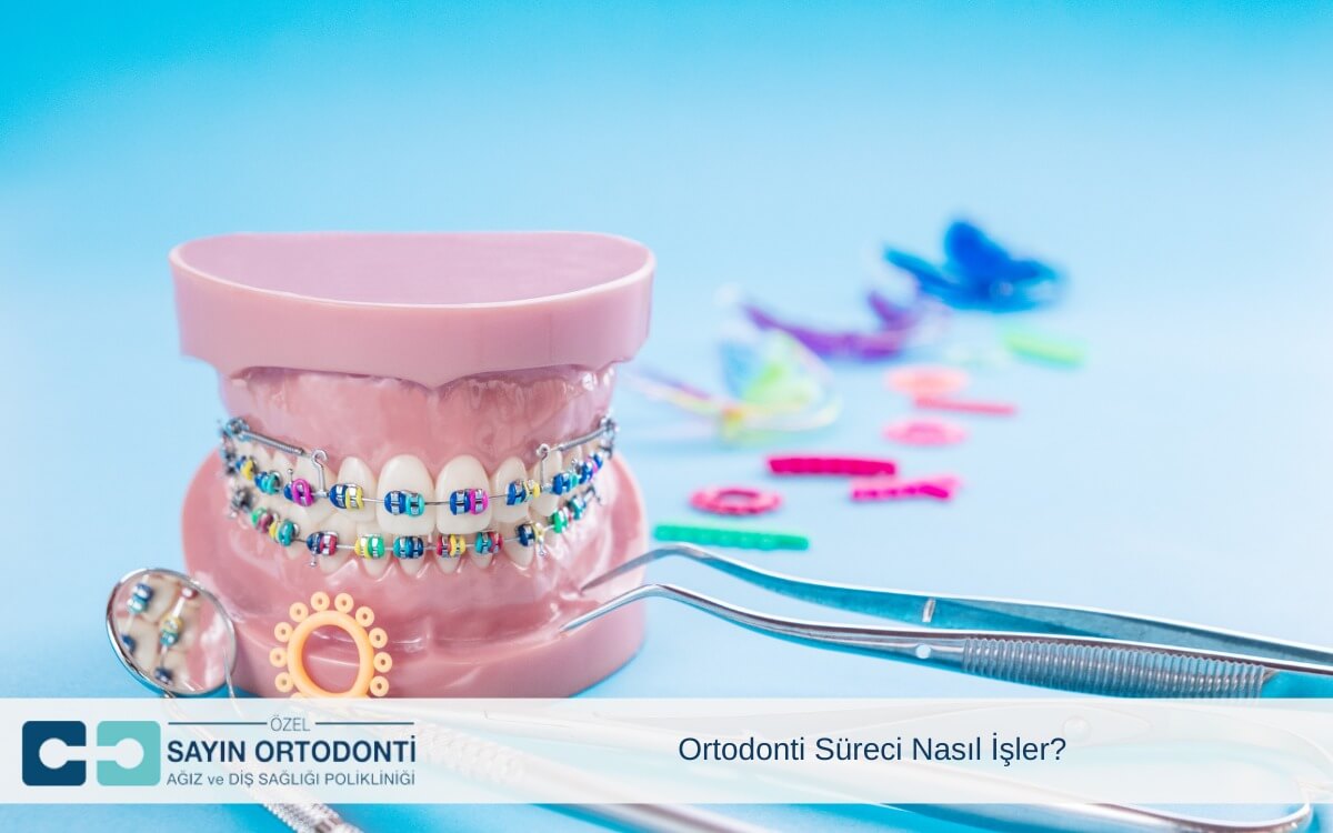 Ortodonti Süreci Nasıl İşler