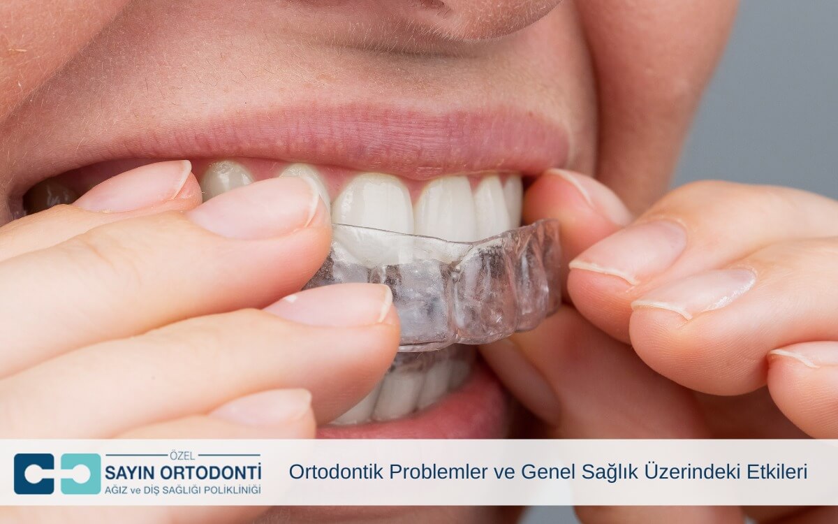 Ortodontik Problemler ve Genel Sağlık Üzerindeki Etkileri