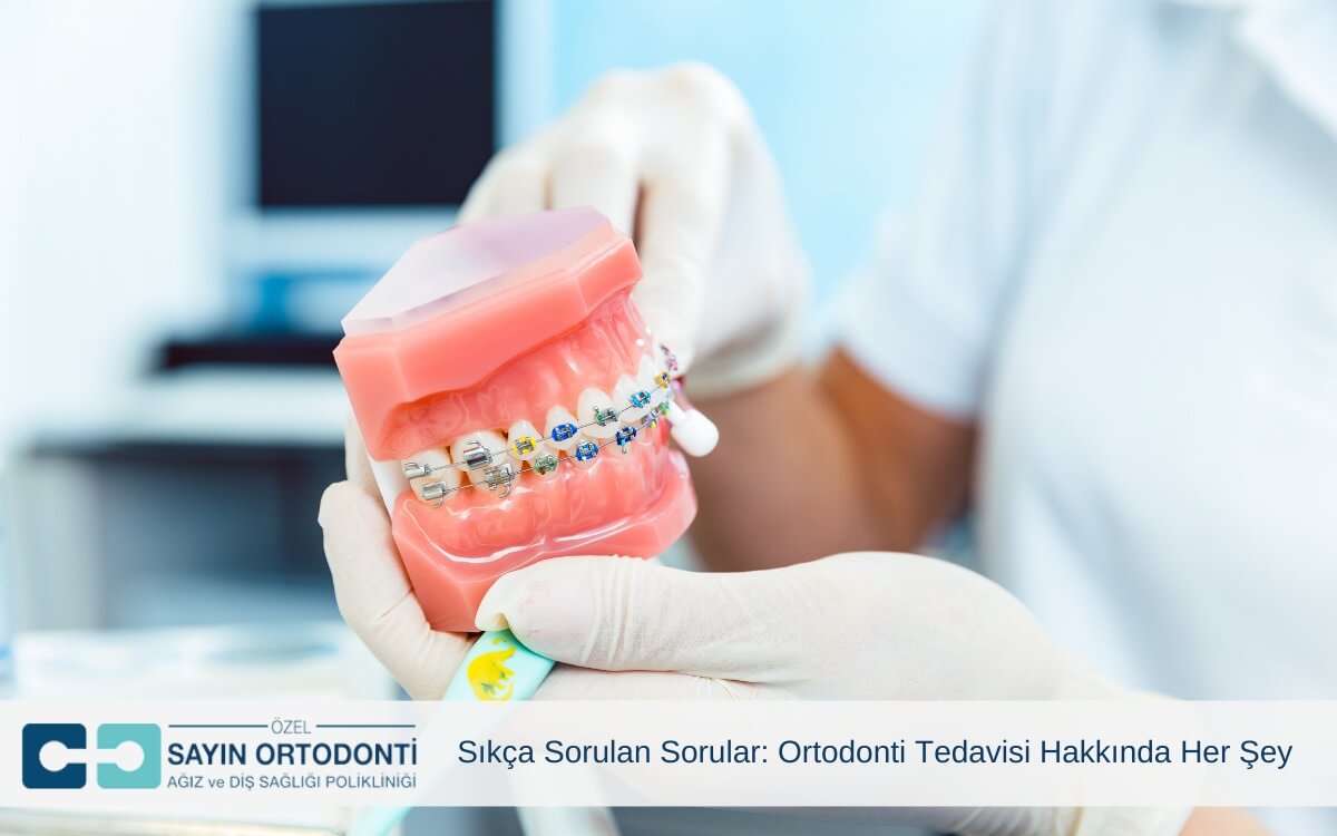 Ortodonti Tedavisi Hakkında Her Şey